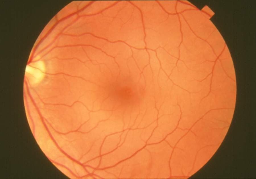 Retinal fundus photograph at the centre of the body's systems